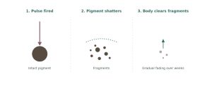 An illustrative sequence showing the process of pigment fading with three steps: pulse fired, pigment shatters, and the body clears fragments over time.