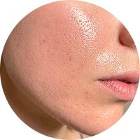 A close-up view of healthy glowing skin showing a smooth texture and natural radiance.