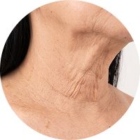 A close-up view of the neck showing skin with visible wrinkles and texture.