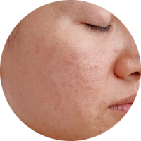 A close-up view of a person's skin showing dullness and uneven tone, highlighting imperfections such as blemishes.