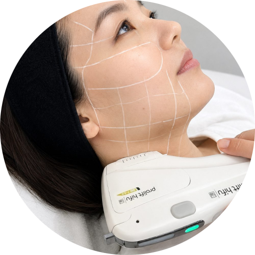 A woman receiving HIFU skin tightening treatment on her face with a device.