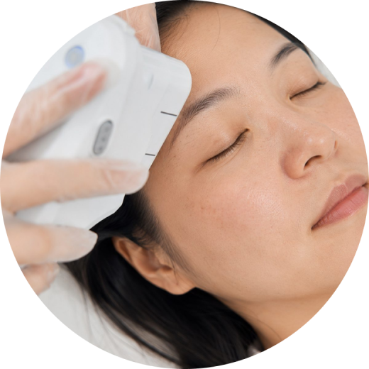 A person receiving a HIFU Liftera treatment for facial rejuvenation.