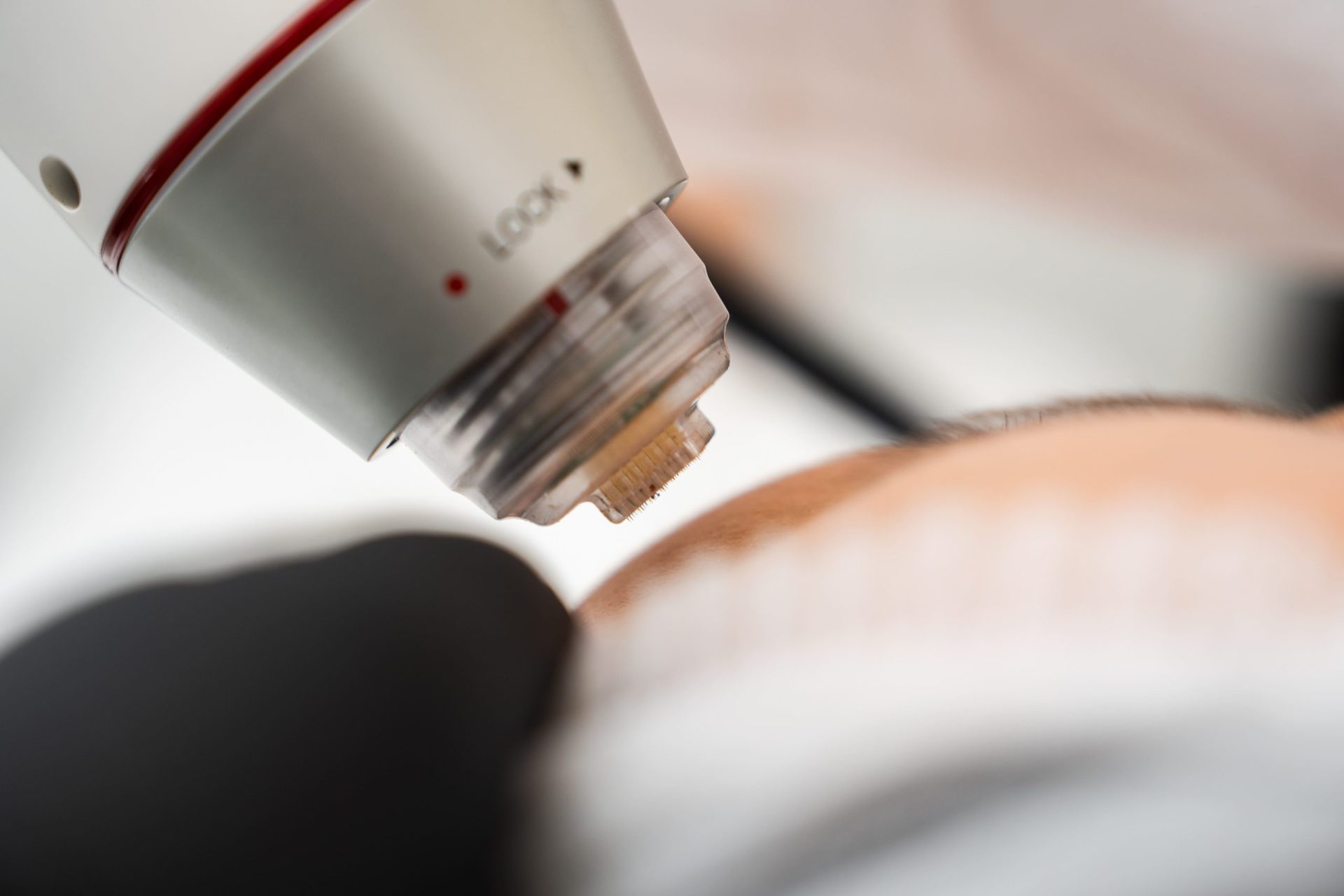 A close-up view of a laser device being used for skin rejuvenation treatment.