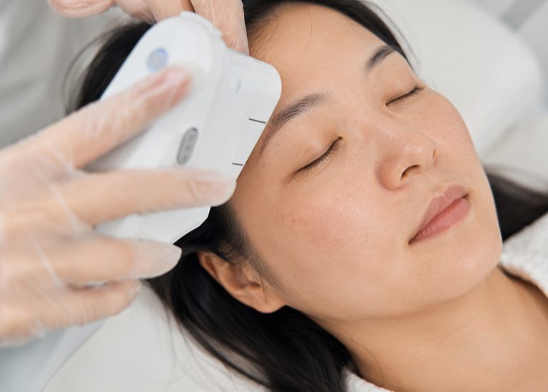 A patient receiving HIFU treatment on the forehead in a clinical setting.