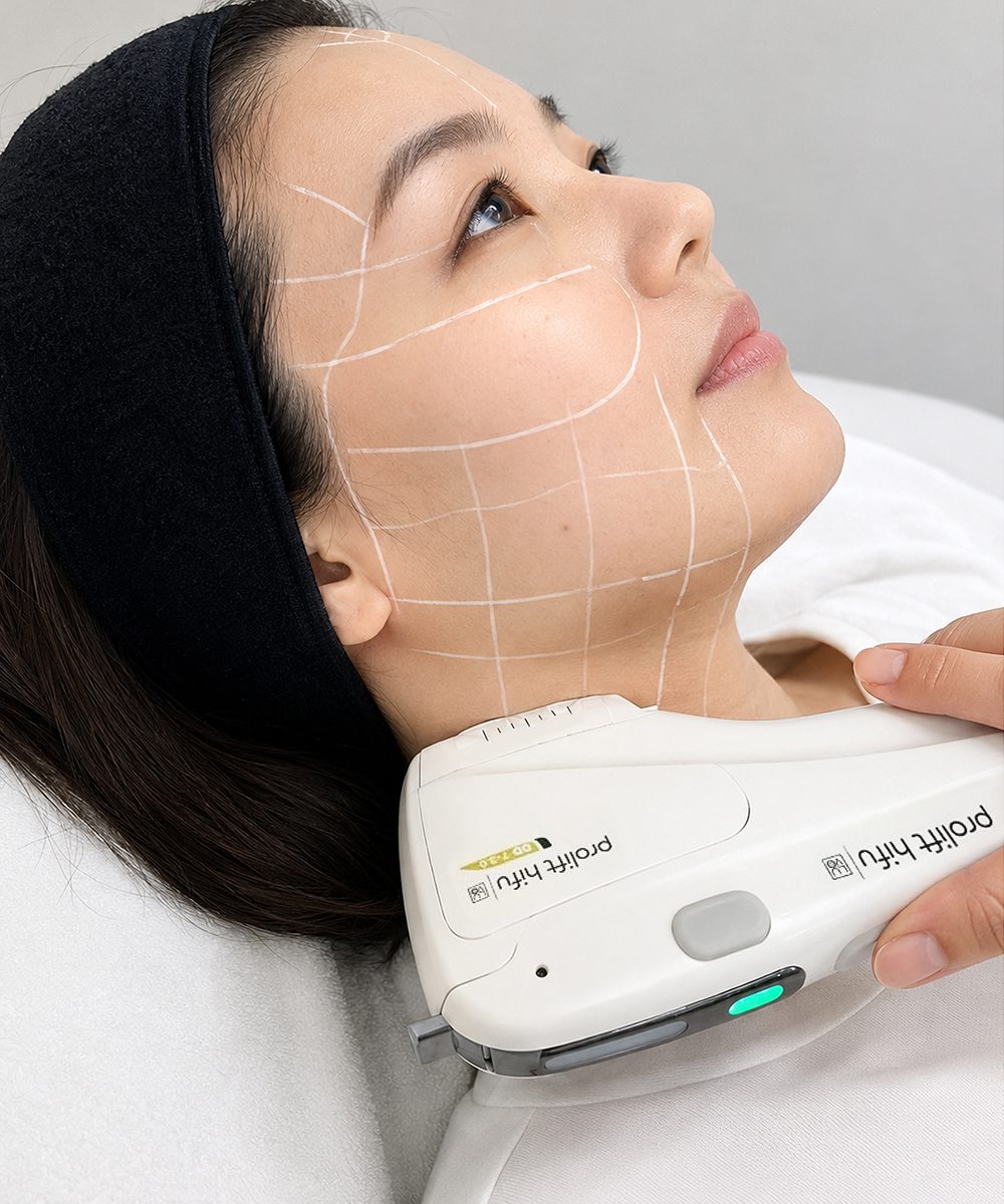 A woman undergoing HIFU treatment with a device being placed on her face, marked with a grid pattern, in a clinical setting.
