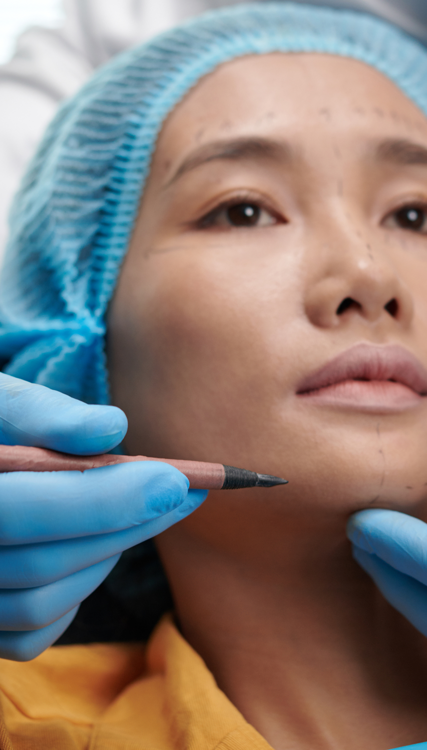 A woman receiving a cosmetic treatment with markings on her face, as a practitioner prepares to perform the procedure.