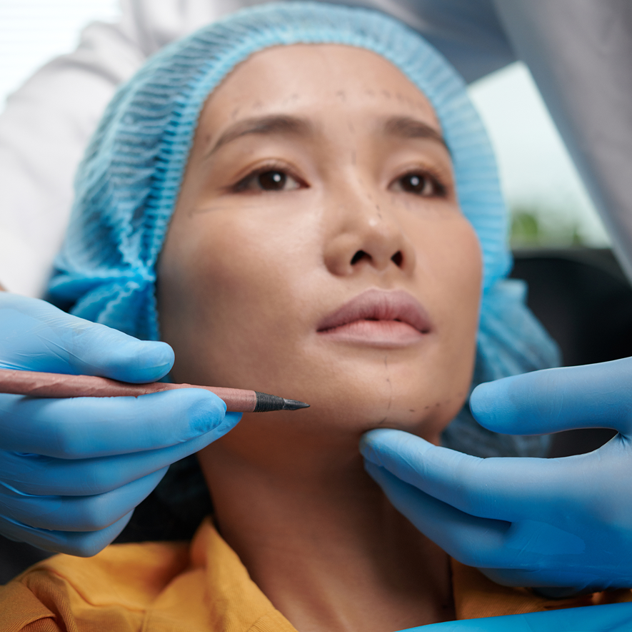 A woman undergoing a cosmetic treatment procedure with markings on her face, while a medical professional holds a pencil to draw adjustments.