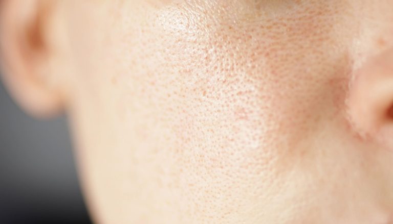 A close-up view of skin texture showing fine details.