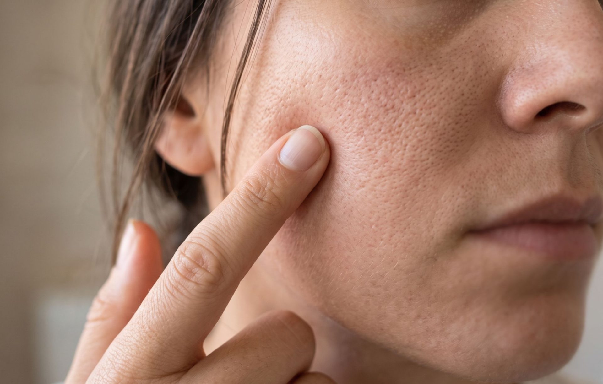 A close-up view of a woman's face showing skin texture, with a finger touching her cheek.
